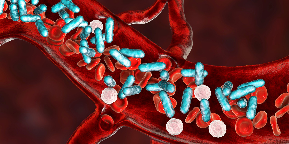 Neues Verfahren QS SEPSIS